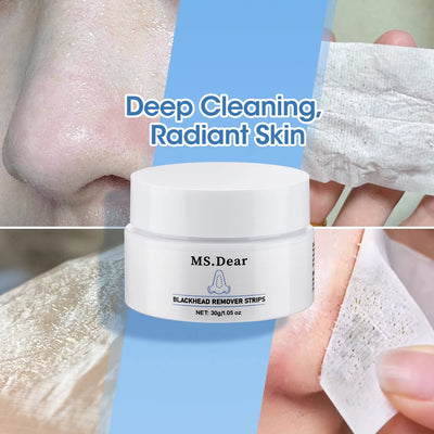 Say Goodbye to Blackheads: LANBENA's Deep Cleansing Pore Strips for Radiant Skin!