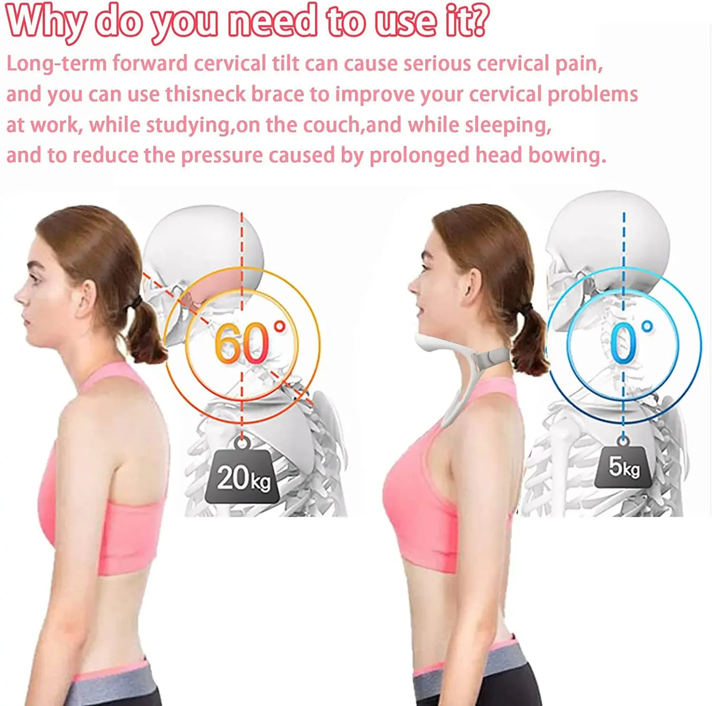 Posture Corrector Neck Brace – Cervical Traction Device for Neck Support and Pain Relief – Prevent Head Drooping and Improve Posture