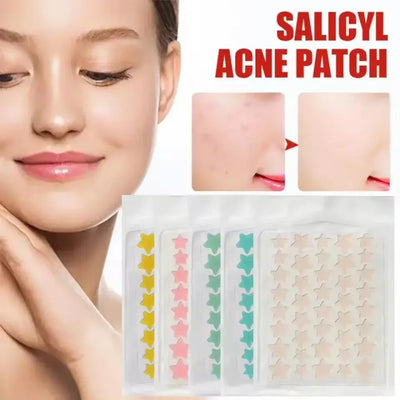 Pimple Emergency? Patch It Overnight! – Hydrocolloid Acne Healing Patches