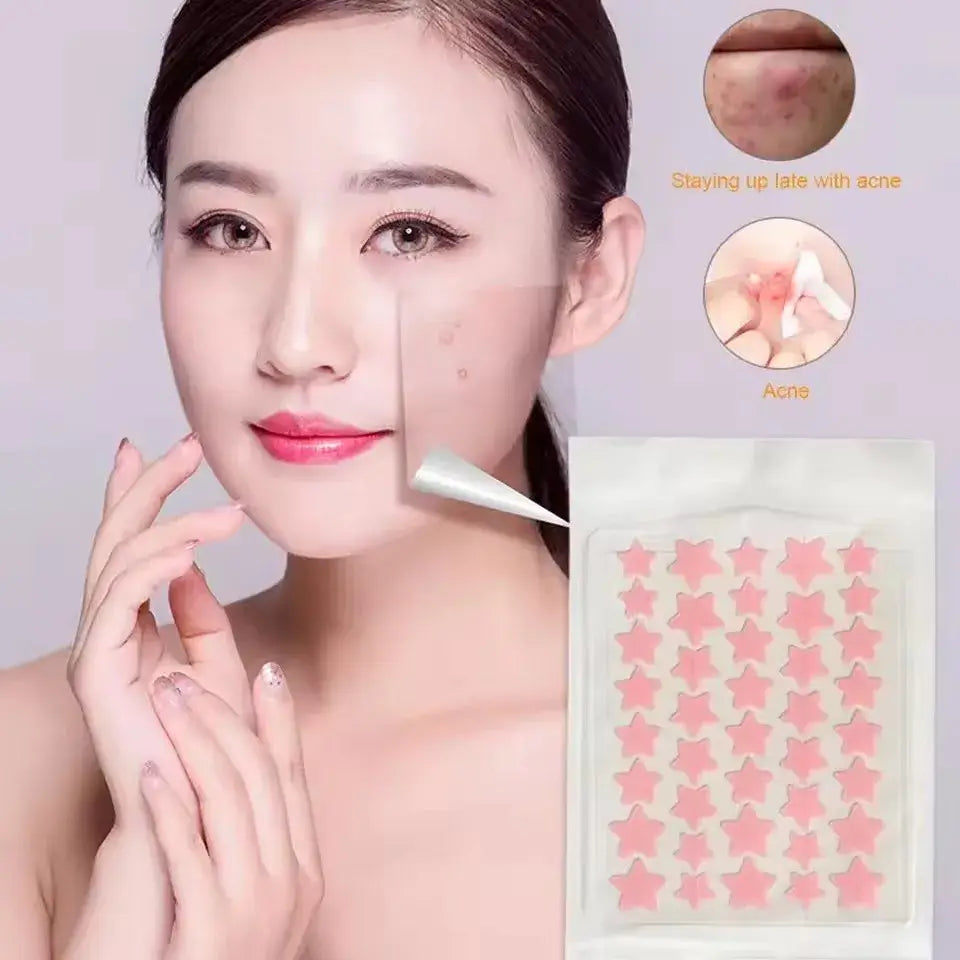 Pimple Emergency? Patch It Overnight! – Hydrocolloid Acne Healing Patches
